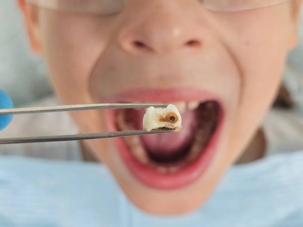 Best Emergency Dentist for Kids  in Newport, MN